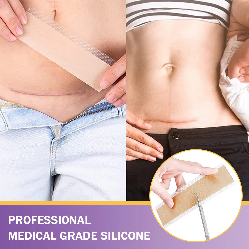 ✨ SEAGRIL® Official – Clinically Proven Scar & Skin Repair Tape Fade old scars, restore smoothness, and rebuild confidence — trusted by dermatologists. - Image 5