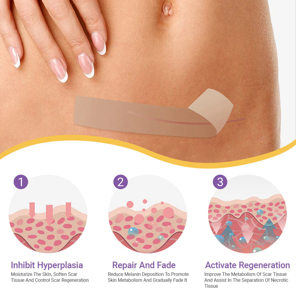 ✨ SEAGRIL® Official – Clinically Proven Scar & Skin Repair Tape Fade old scars, restore smoothness, and rebuild confidence — trusted by dermatologists. - Image 6