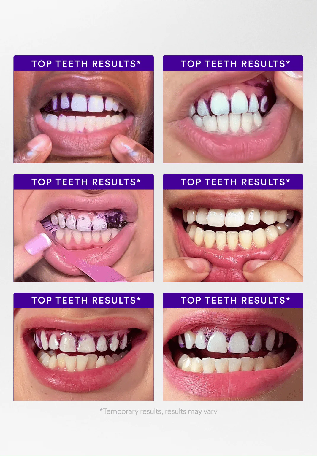 Teeth Whitening Strips - Image 4