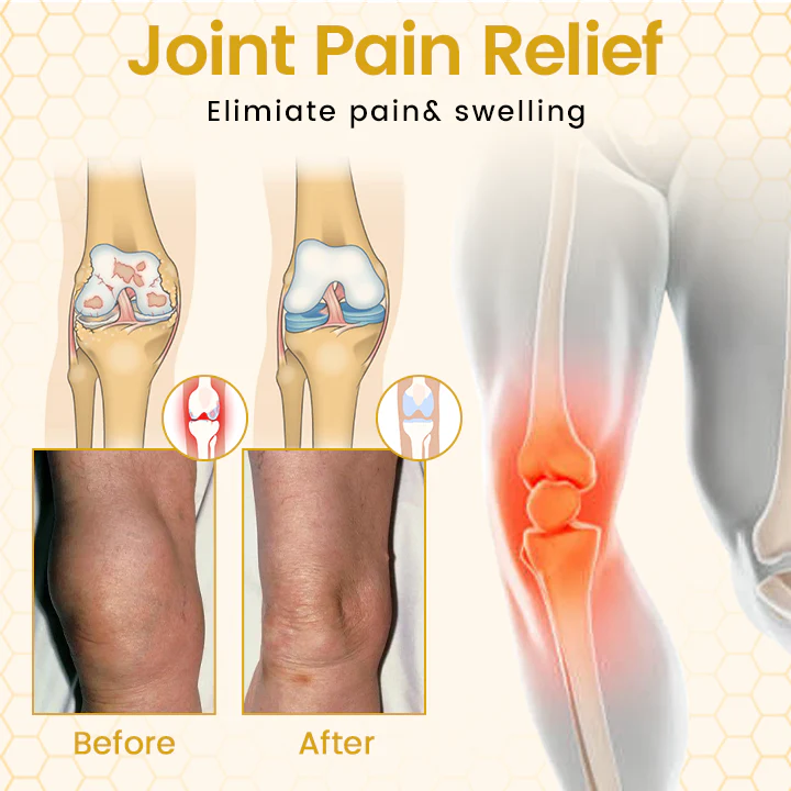 SEAGRIL® VenomFlex Bee Therapy Cream - Image 3